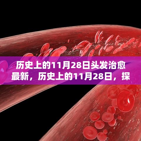 歷史上的11月28日，探尋頭發(fā)治愈的最新篇章??