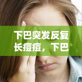 下巴突發(fā)反復(fù)長(zhǎng)痘痘，下巴突發(fā)性長(zhǎng)痘 