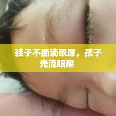 孩子不斷淌眼屎，孩子光流眼屎 