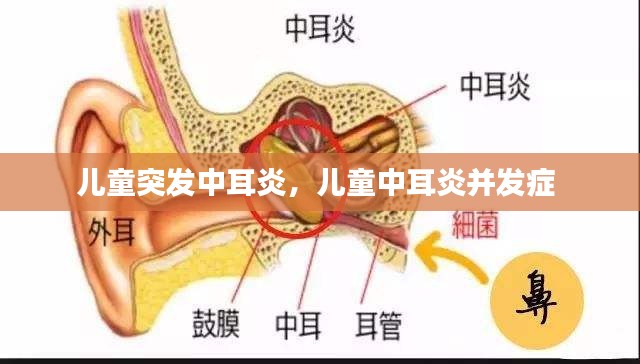 兒童突發(fā)中耳炎，兒童中耳炎并發(fā)癥 